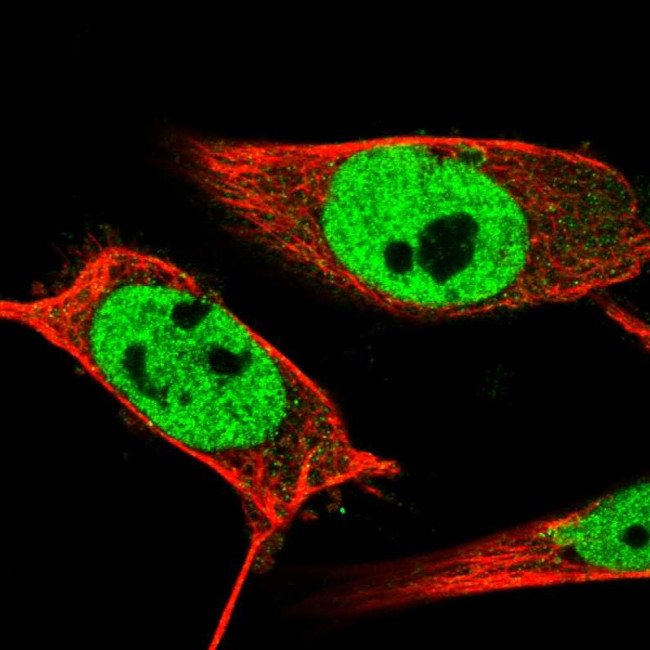 ING2 Antibody in Immunocytochemistry (ICC/IF)