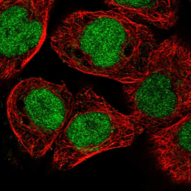 ELAC2 Antibody in Immunocytochemistry (ICC/IF)