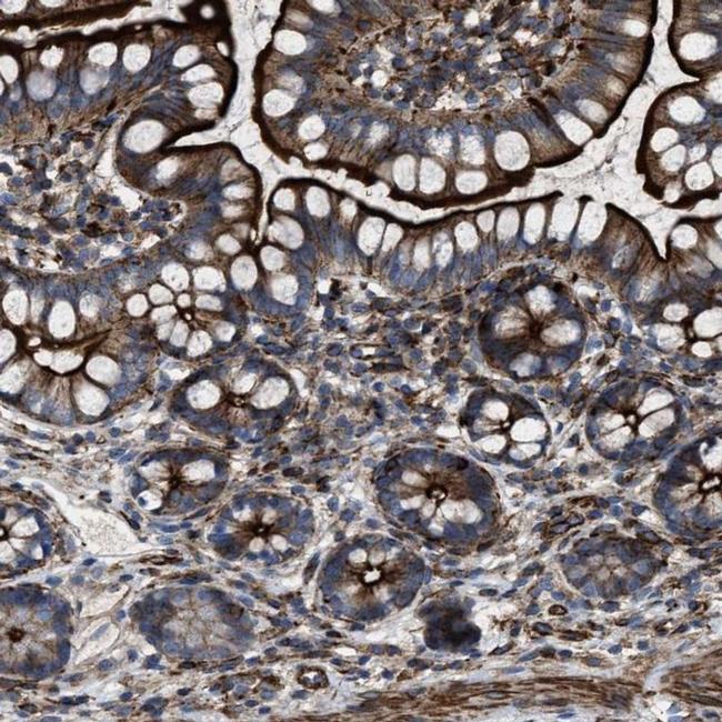 AGPAT2 Antibody in Immunohistochemistry (IHC)