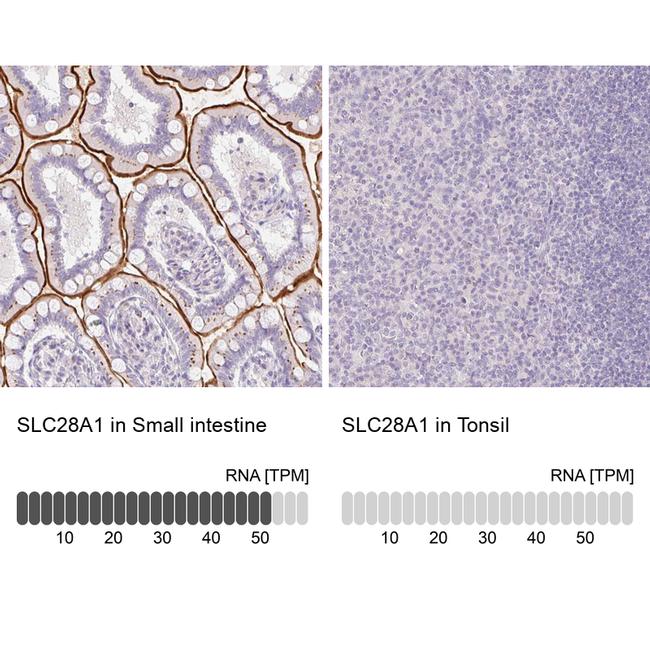 SLC28A1 Antibody in Immunohistochemistry (IHC)