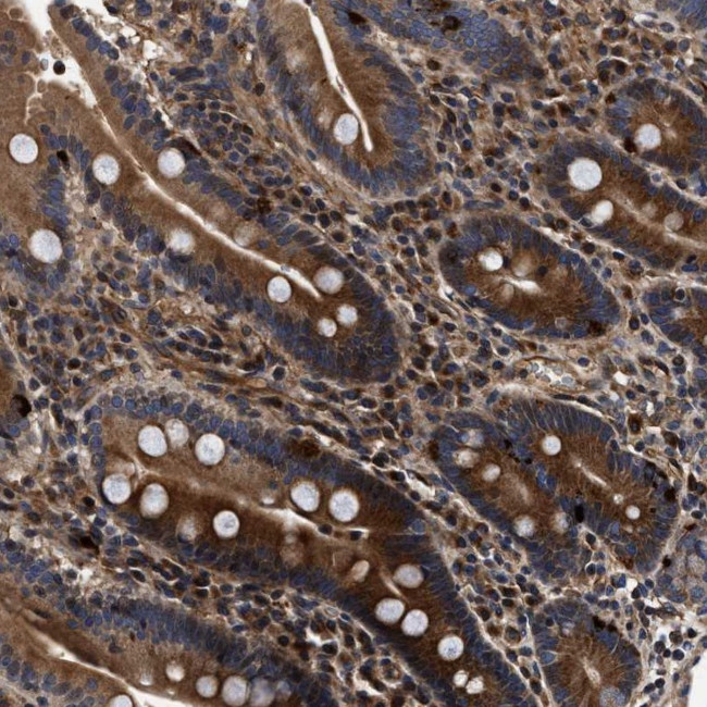 ABCG8 Antibody in Immunohistochemistry (Paraffin) (IHC (P))