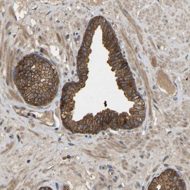 EDG4 Antibody in Immunohistochemistry (Paraffin) (IHC (P))