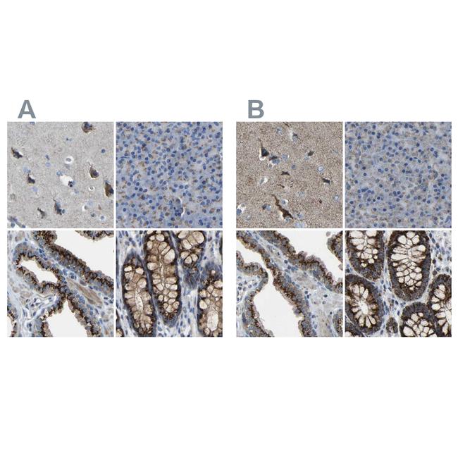 CANT1 Antibody in Immunohistochemistry (IHC)