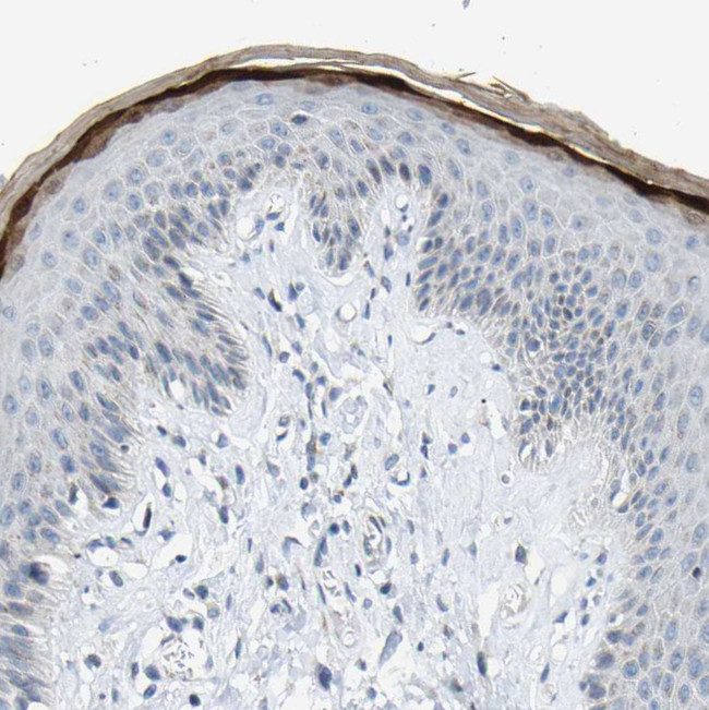 KRT76 Antibody in Immunohistochemistry (Paraffin) (IHC (P))