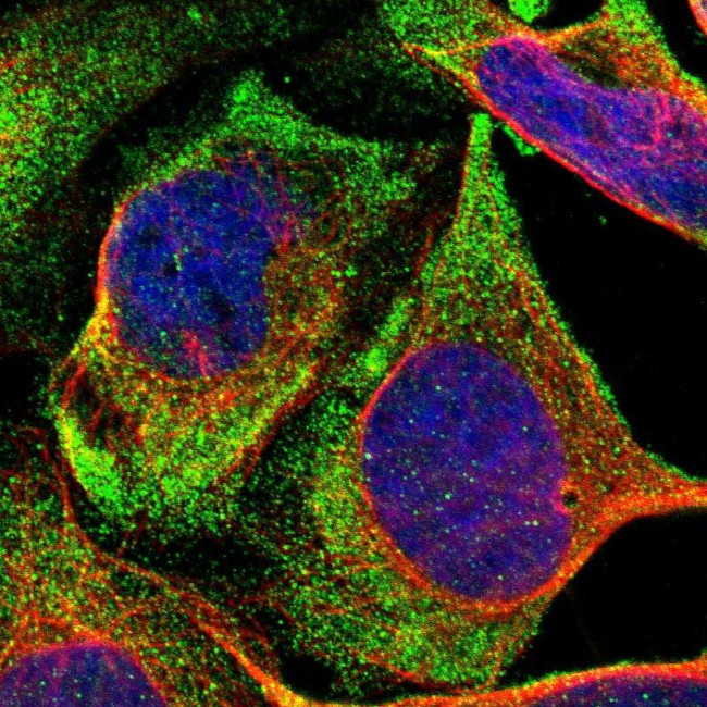 NOV Antibody in Immunocytochemistry (ICC/IF)