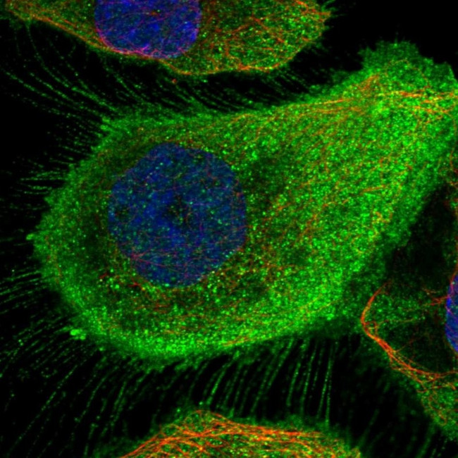 Myotrophin Antibody in Immunocytochemistry (ICC/IF)