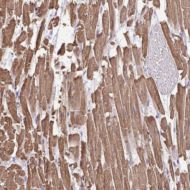 MYL2 Antibody in Immunohistochemistry (Paraffin) (IHC (P))