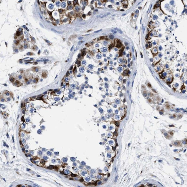 OR10G3 Antibody in Immunohistochemistry (Paraffin) (IHC (P))