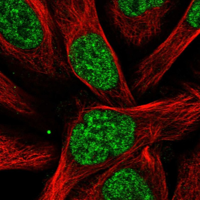 RBM15 Antibody in Immunocytochemistry (ICC/IF)