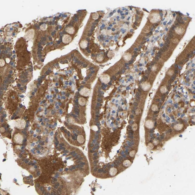 TPMT Antibody in Immunohistochemistry (Paraffin) (IHC (P))