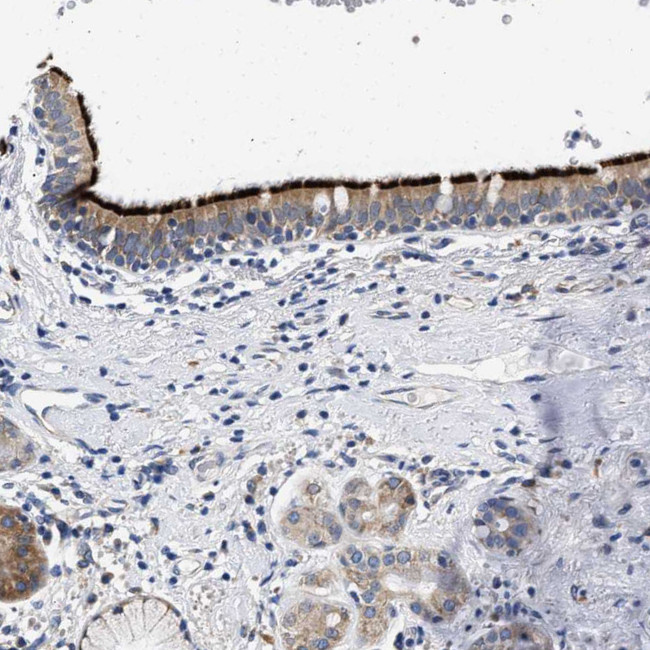 RINT1 Antibody in Immunohistochemistry (Paraffin) (IHC (P))