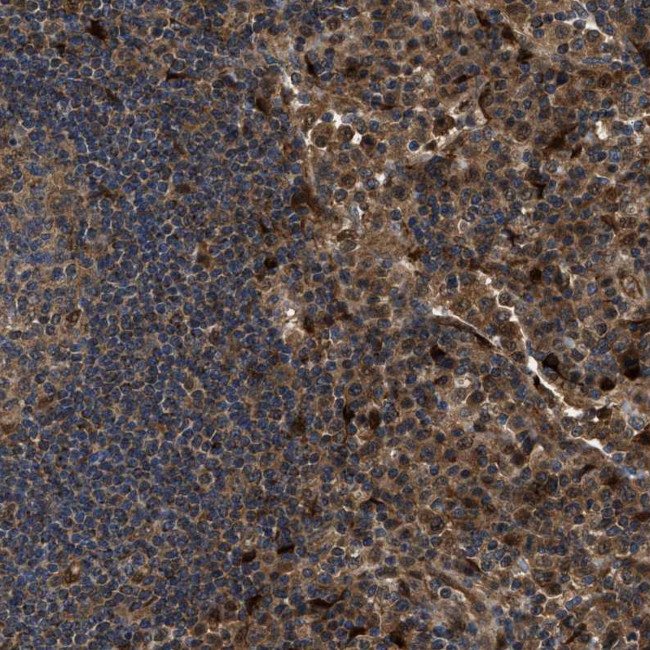 PPA1 Antibody in Immunohistochemistry (Paraffin) (IHC (P))