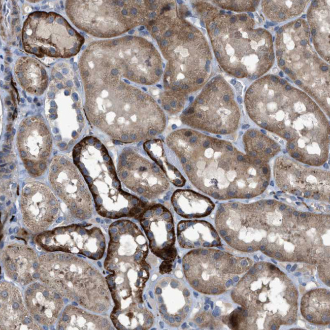 URG4 Antibody in Immunohistochemistry (Paraffin) (IHC (P))