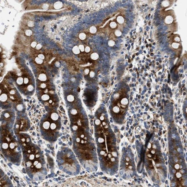 IL17RC Antibody in Immunohistochemistry (IHC)