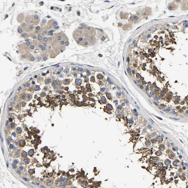 Bif1 Antibody in Immunohistochemistry (Paraffin) (IHC (P))