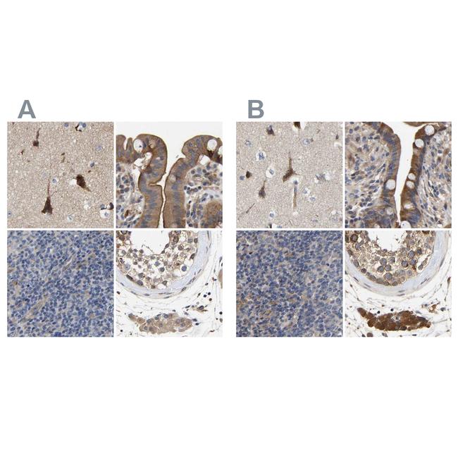 CCDC155 Antibody in Immunohistochemistry (IHC)