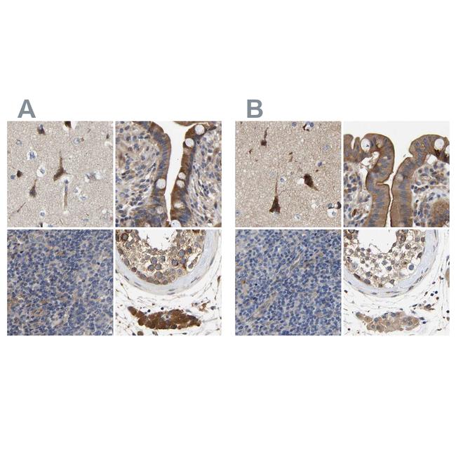 CCDC155 Antibody in Immunohistochemistry (IHC)