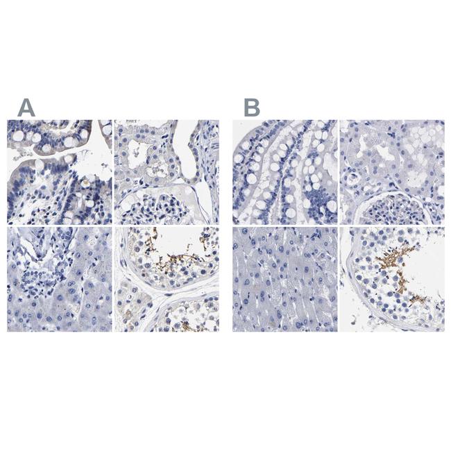 AKAP4 Antibody in Immunohistochemistry (IHC)