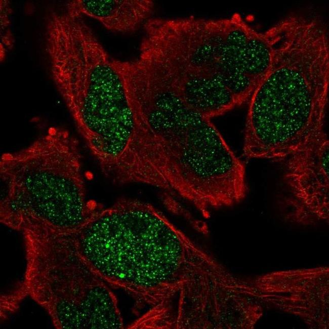 GEN1 Antibody in Immunocytochemistry (ICC/IF)