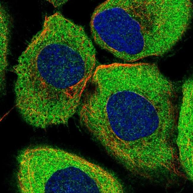 ABCF2 Antibody in Immunocytochemistry (ICC/IF)