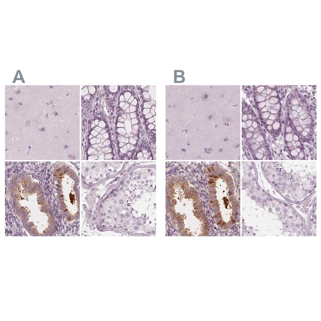 PAEP Antibody in Immunohistochemistry (IHC)