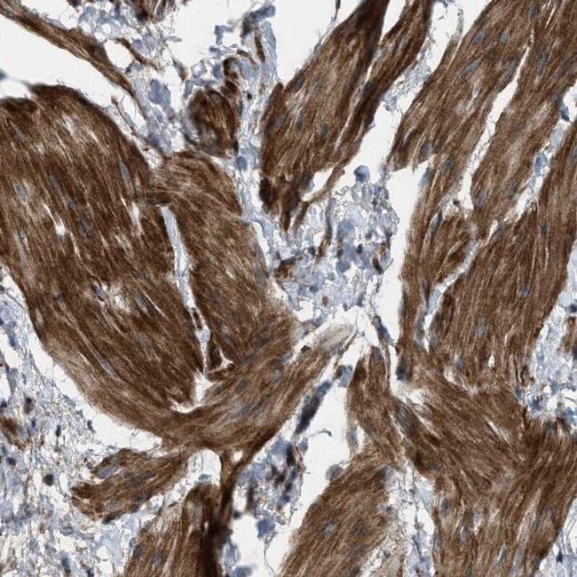 URG4 Antibody in Immunohistochemistry (IHC)