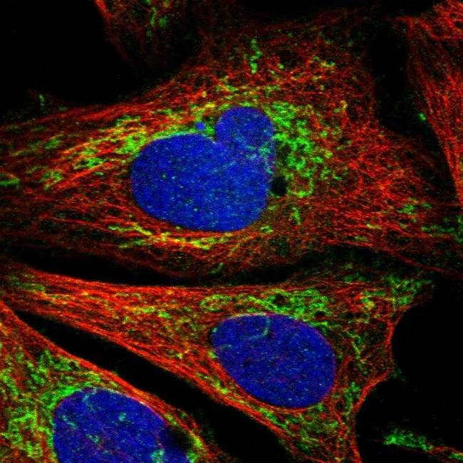 CCM2 Antibody in Immunocytochemistry (ICC/IF)