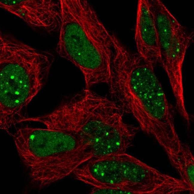 BCL9 Antibody in Immunocytochemistry (ICC/IF)