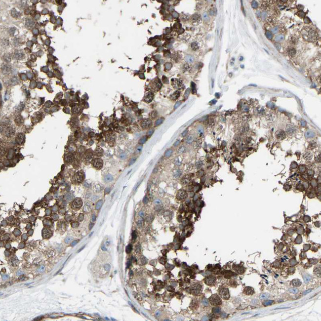 VPS41 Antibody in Immunohistochemistry (Paraffin) (IHC (P))