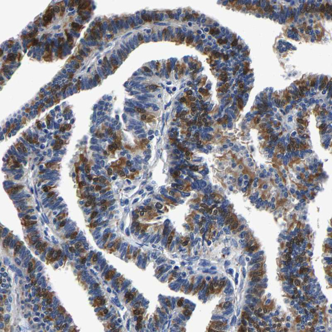 PSPH Antibody in Immunohistochemistry (Paraffin) (IHC (P))