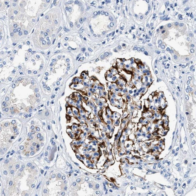 MED22 Antibody in Immunohistochemistry (Paraffin) (IHC (P))