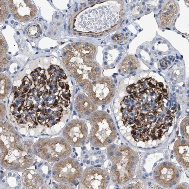 PKD1L1 Antibody in Immunohistochemistry (Paraffin) (IHC (P))