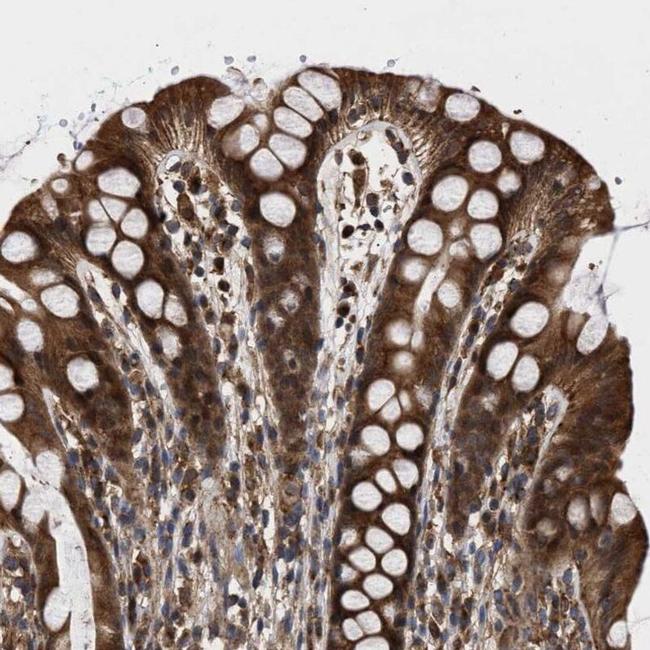 CLIP2 Antibody in Immunohistochemistry (IHC)