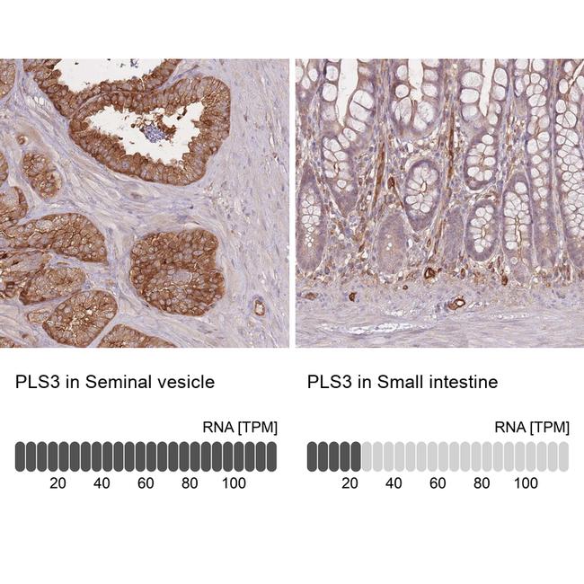 PLS3 Antibody in Immunohistochemistry (IHC)