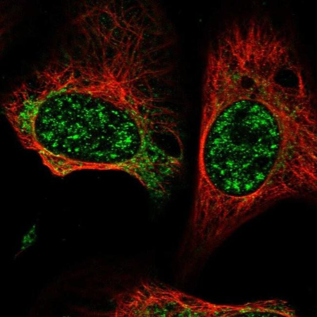 GCAT Antibody in Immunocytochemistry (ICC/IF)