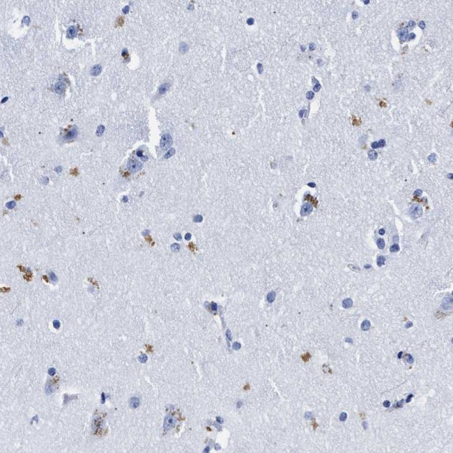 LRRC8E Antibody in Immunohistochemistry (Paraffin) (IHC (P))