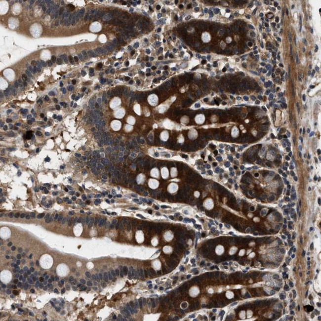 ZCCHC6 Antibody in Immunohistochemistry (Paraffin) (IHC (P))