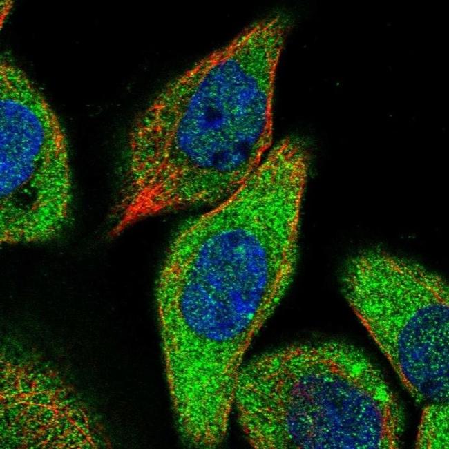 ZCCHC6 Antibody in Immunocytochemistry (ICC/IF)