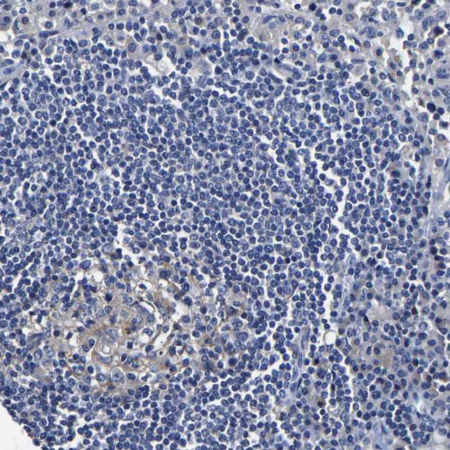 SLCO2B1 Antibody in Immunohistochemistry (IHC)