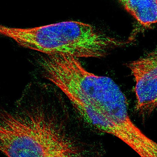 AASS Antibody in Immunocytochemistry (ICC/IF)