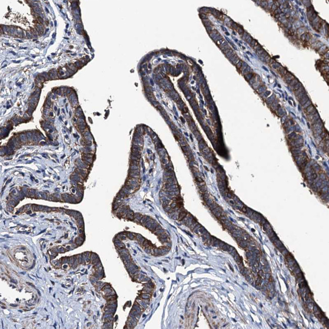 NEK1 Antibody in Immunohistochemistry (Paraffin) (IHC (P))