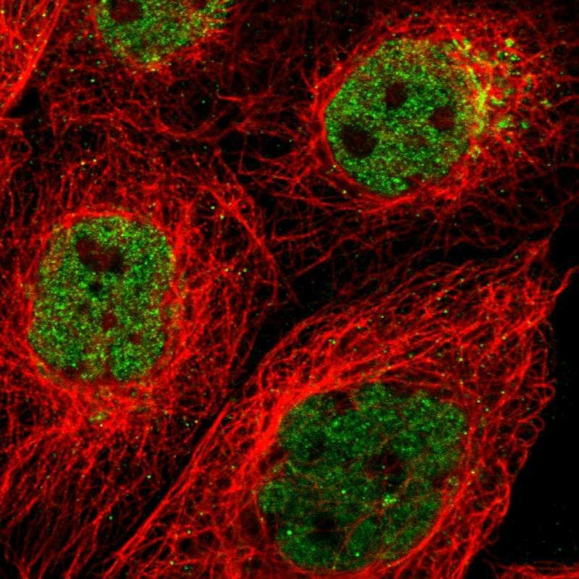 ZMYND8 Antibody in Immunocytochemistry (ICC/IF)