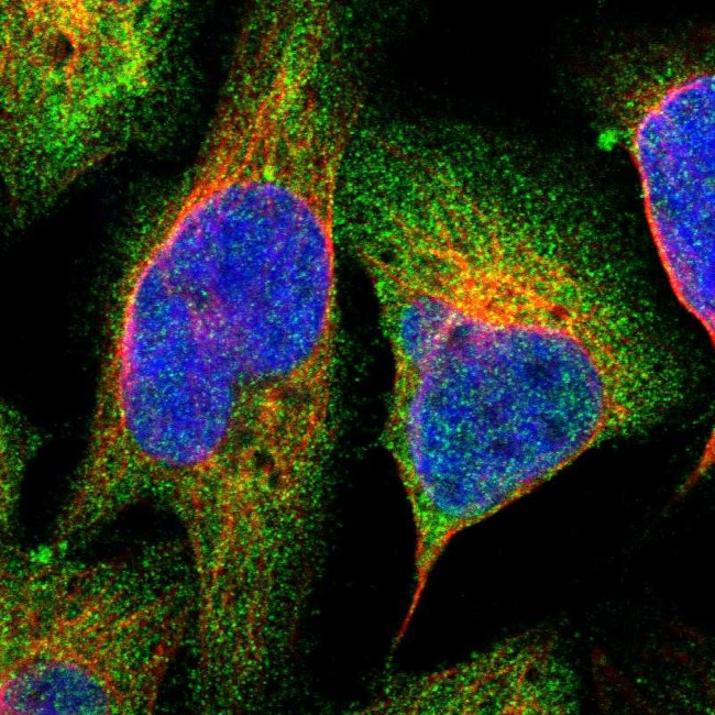 PLAA Antibody in Immunocytochemistry (ICC/IF)