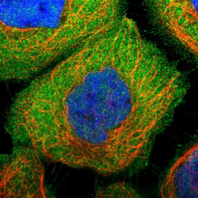 PLAA Antibody in Immunocytochemistry (ICC/IF)