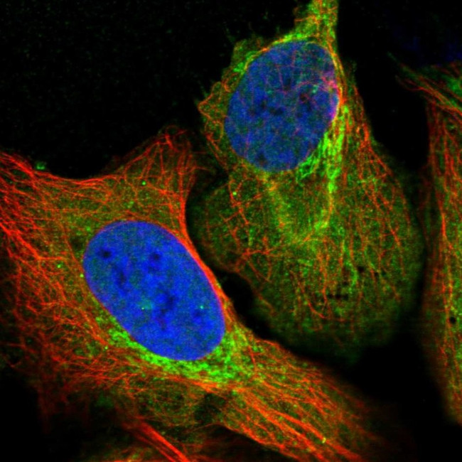 ALDH1B1 Antibody in Immunocytochemistry (ICC/IF)