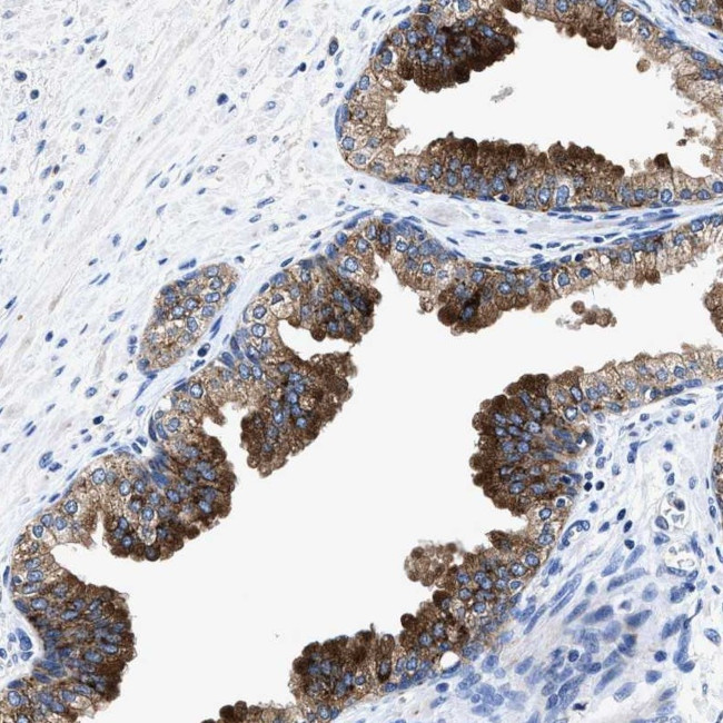 UBR4 Antibody in Immunohistochemistry (Paraffin) (IHC (P))