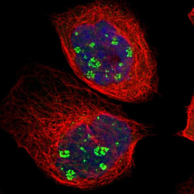 KBTBD2 Antibody in Immunocytochemistry (ICC/IF)