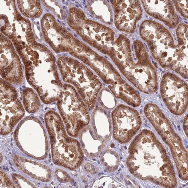 GEN1 Antibody in Immunohistochemistry (Paraffin) (IHC (P))