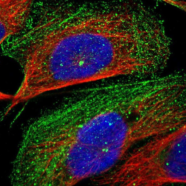 CROCC Antibody in Immunocytochemistry (ICC/IF)