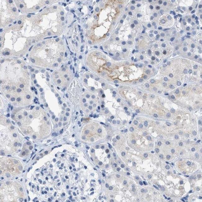 KIFC3 Antibody in Immunohistochemistry (IHC)